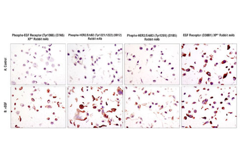 SignalSlide Phospho-ErbB Family IHC Controls 1 pack