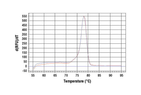 SimpleChIP Human DMD Intron 2 Primers 500 µl