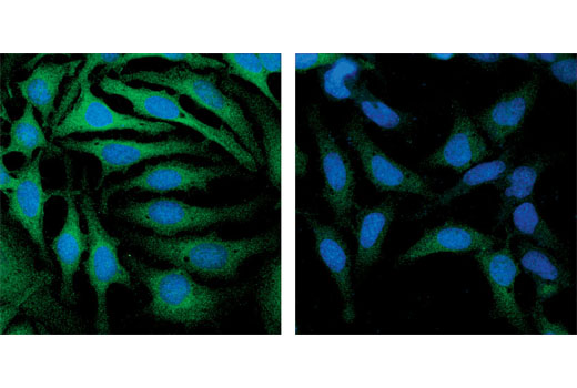 SignalSilence GSK-3alpha/beta siRNA 300 µl
