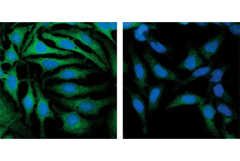 SignalSilence GSK-3alpha/beta siRNA 300 µl