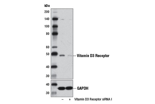 SignalSilence Vitamin D3 Receptor siRNA I 300 µl