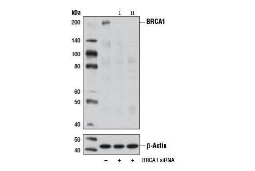 SignalSilence BRCA1 siRNA I 300 µl