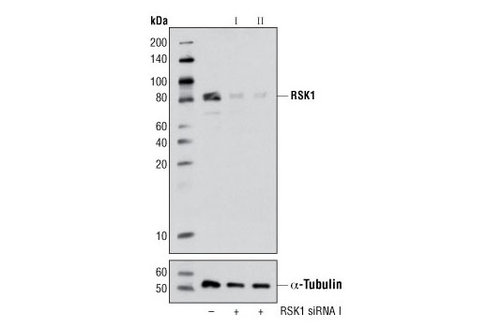 SignalSilence RSK1 siRNA I 300 µl
