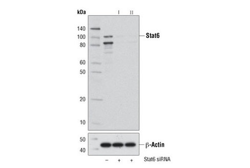 SignalSilence Stat6 siRNA II 300 µl