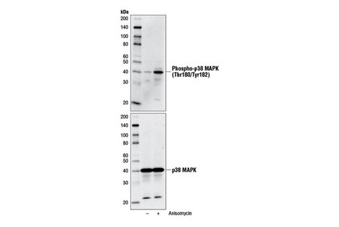 P38 MAPK Control Cell Extracts 150 µl
