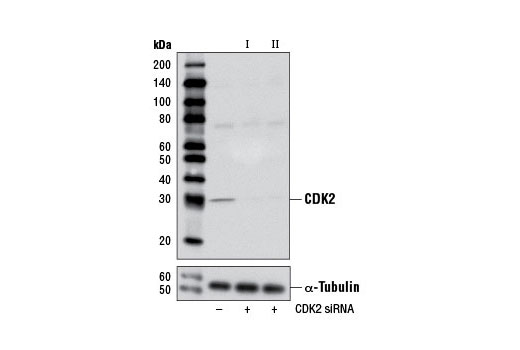 SignalSilence CDK2 siRNA I 300 µl