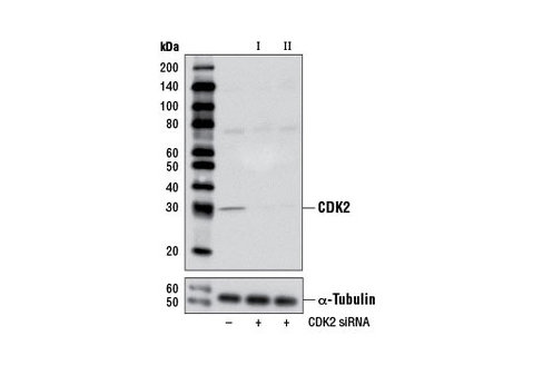 SignalSilence CDK2 siRNA I 300 µl