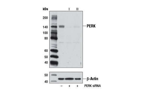 SignalSilence PERK siRNA I 300 µl