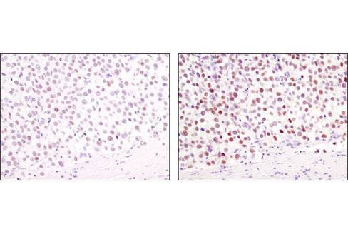 SignalStain Boost IHC Detection Reagent (HRP, Mouse) 1 mL