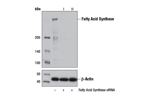 SignalSilence Fatty Acid Synthase siRNA II 300 µl