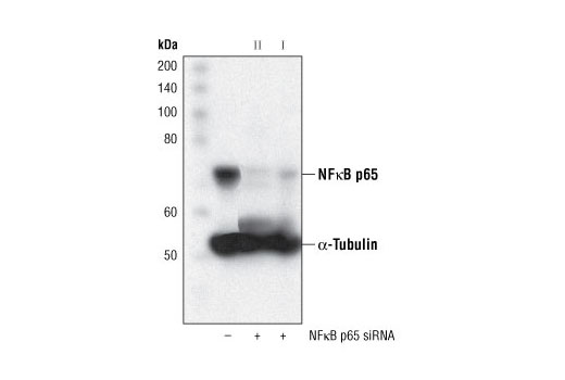 SignalSilence NF-kappaB p65 siRNA II 300 µl