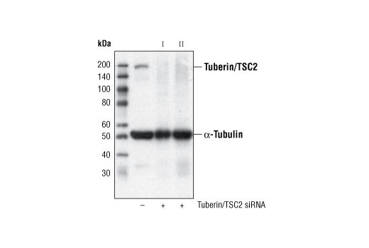 SignalSilence Tuberin/TSC2 siRNA I 300 µl