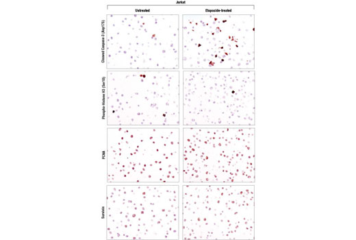 SignalStain Proliferation/Apoptosis IHC Sampler Kit 1 kit