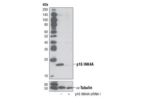 SignalSilence p16 INK4A siRNA I 300 µl