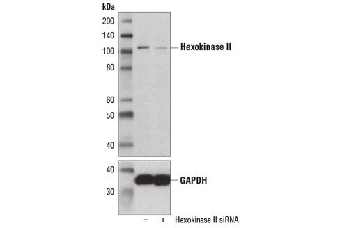 SignalSilence Hexokinase II siRNA I 300 µl
