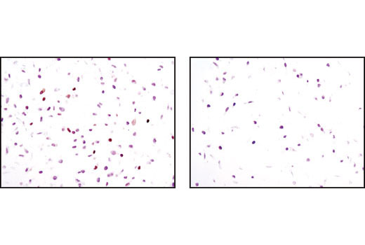 SignalSilence p21 Waf1/Cip1 siRNA II 300 µl
