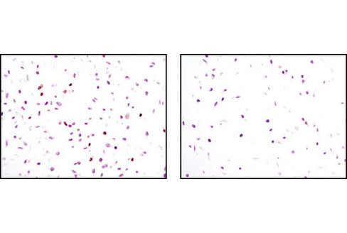 SignalSilence p21 Waf1/Cip1 siRNA II 300 µl
