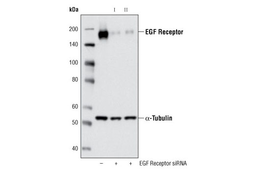 SignalSilence EGF Receptor siRNA II 300 µl