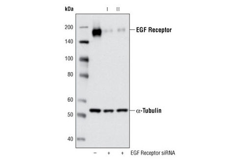 SignalSilence EGF Receptor siRNA II 300 µl