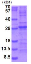 Recombinant Mouse IL-34 protein (denatured)