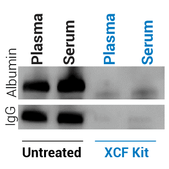 XCF COMPLETE Exosome and cfDNA Isolation Kit (for Serum and Plasma) 20 réactions