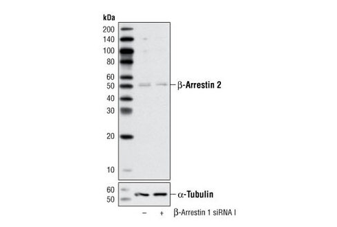 SignalSilence beta-Arrestin 1 siRNA I 300 µl