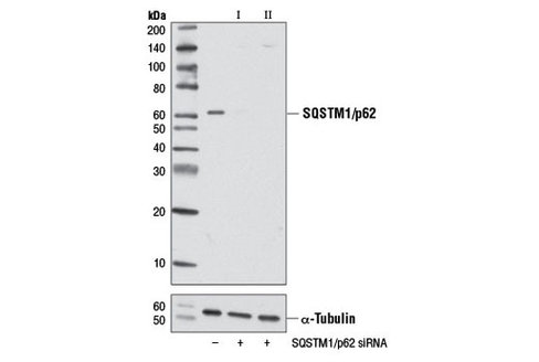 SignalSilence SQSTM1/p62 siRNA I 300 µl