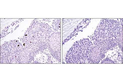 SignalStain Apoptosis (Cleaved Caspase-3) IHC Detection Kit 1 kit