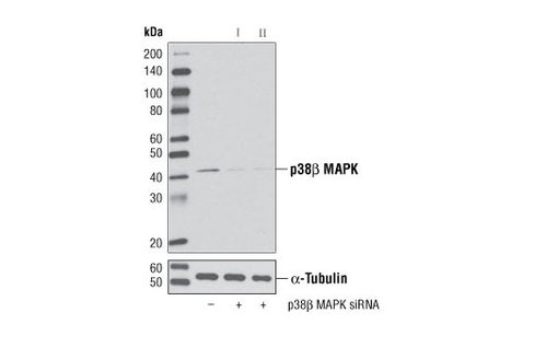 SignalSilence p38beta MAPK siRNA I 300 µl