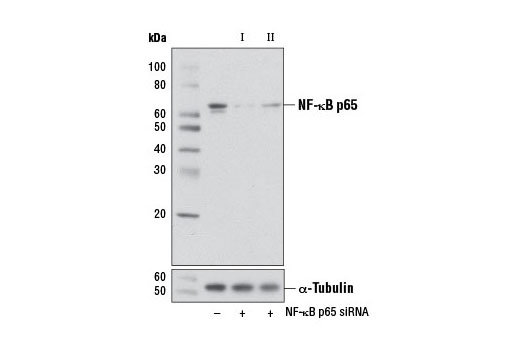 SignalSilence NF-kappaB p65 siRNA I (Mouse Specific) 300 µl