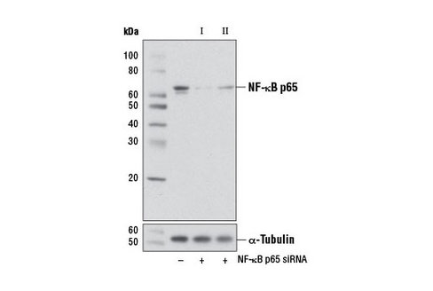 SignalSilence NF-kappaB p65 siRNA I (Mouse Specific) 300 µl