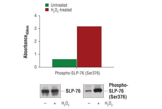 PathScan Phospho-SLP-76 (Ser376)Sandwich ELISA Kit 1 kit