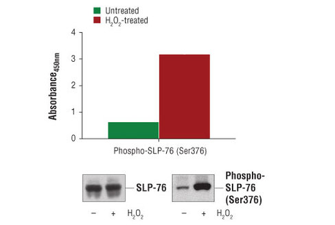 PathScan Phospho-SLP-76 (Ser376)Sandwich ELISA Kit 1 kit