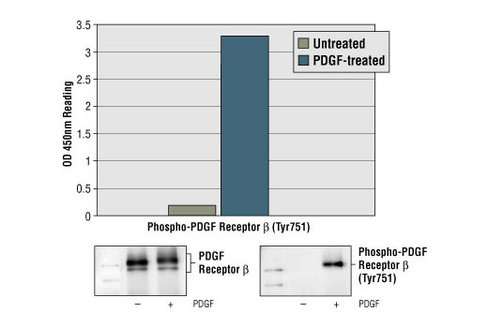 PathScan Phospho-PDGF Receptor beta (Tyr751) Sandwich ELISA Kit 1 kit