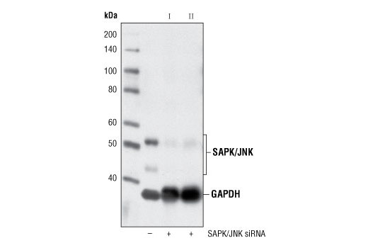SignalSilence SAPK/JNK siRNA I 300 µl