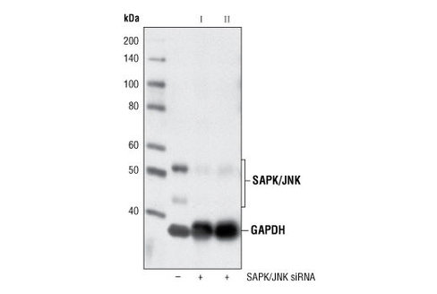 SignalSilence SAPK/JNK siRNA I 300 µl