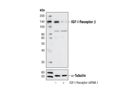 SignalSilence IGF-I Receptor siRNA I 300 µl