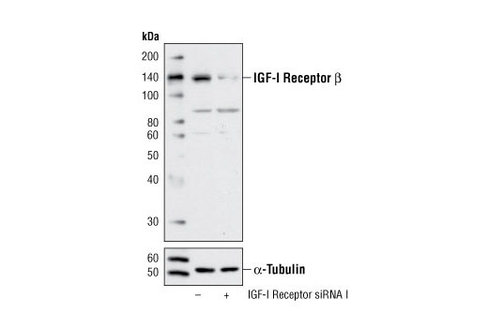SignalSilence IGF-I Receptor siRNA I 300 µl