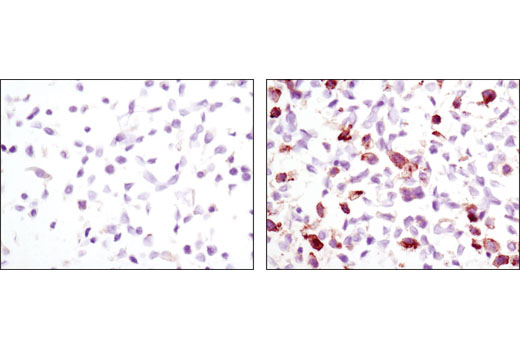 SignalSlide Phospho-EGF Receptor IHC Controls 1 pack