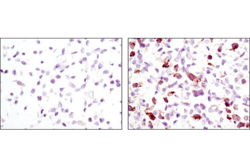 SignalSlide Phospho-EGF Receptor IHC Controls 1 pack