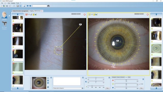 Logiciel EYESUITE pour IM 910