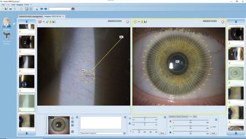 Logiciel EYESUITE pour IM 910