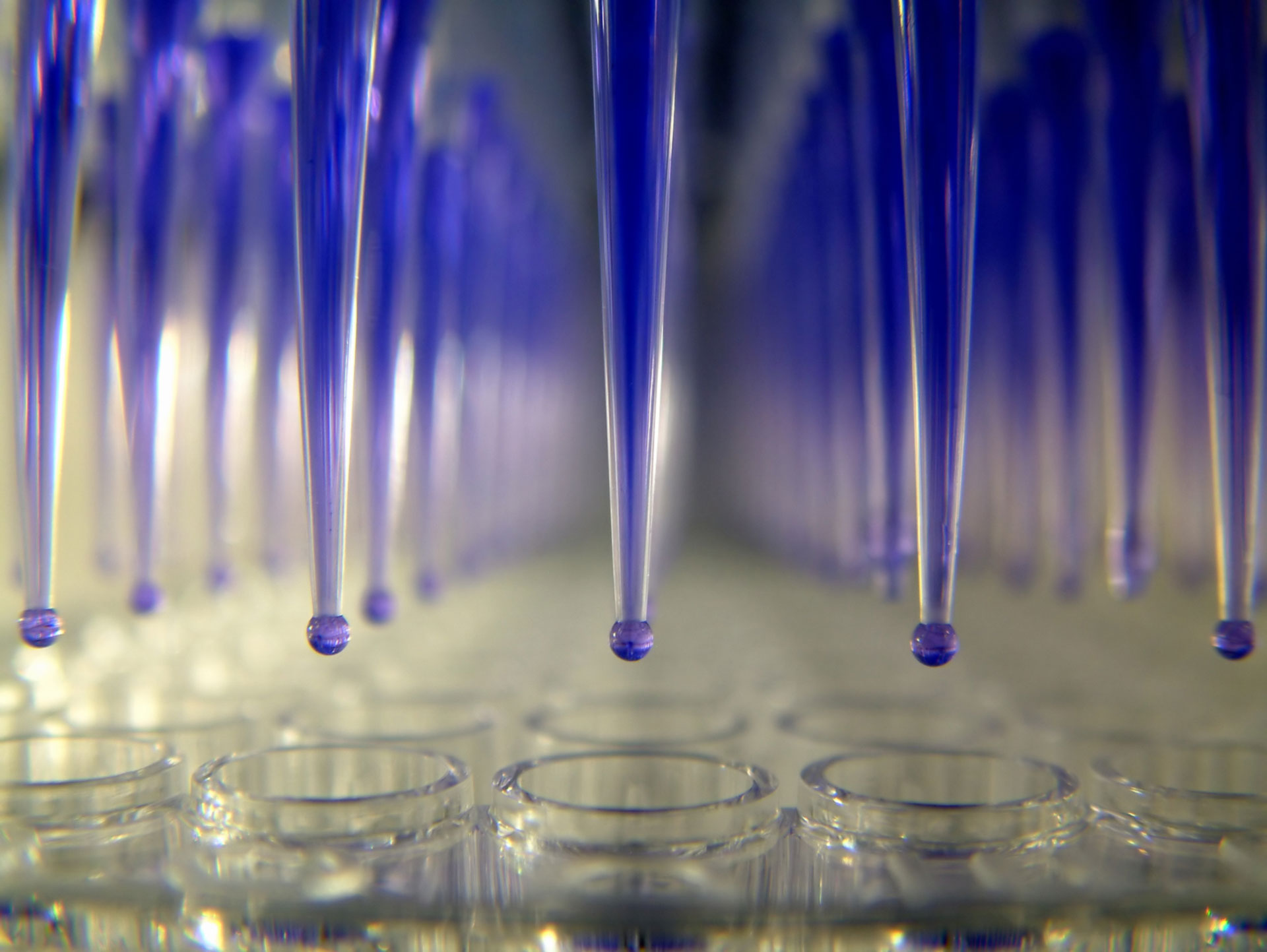 Hsv1 2 igm (igm capture) 96 tests