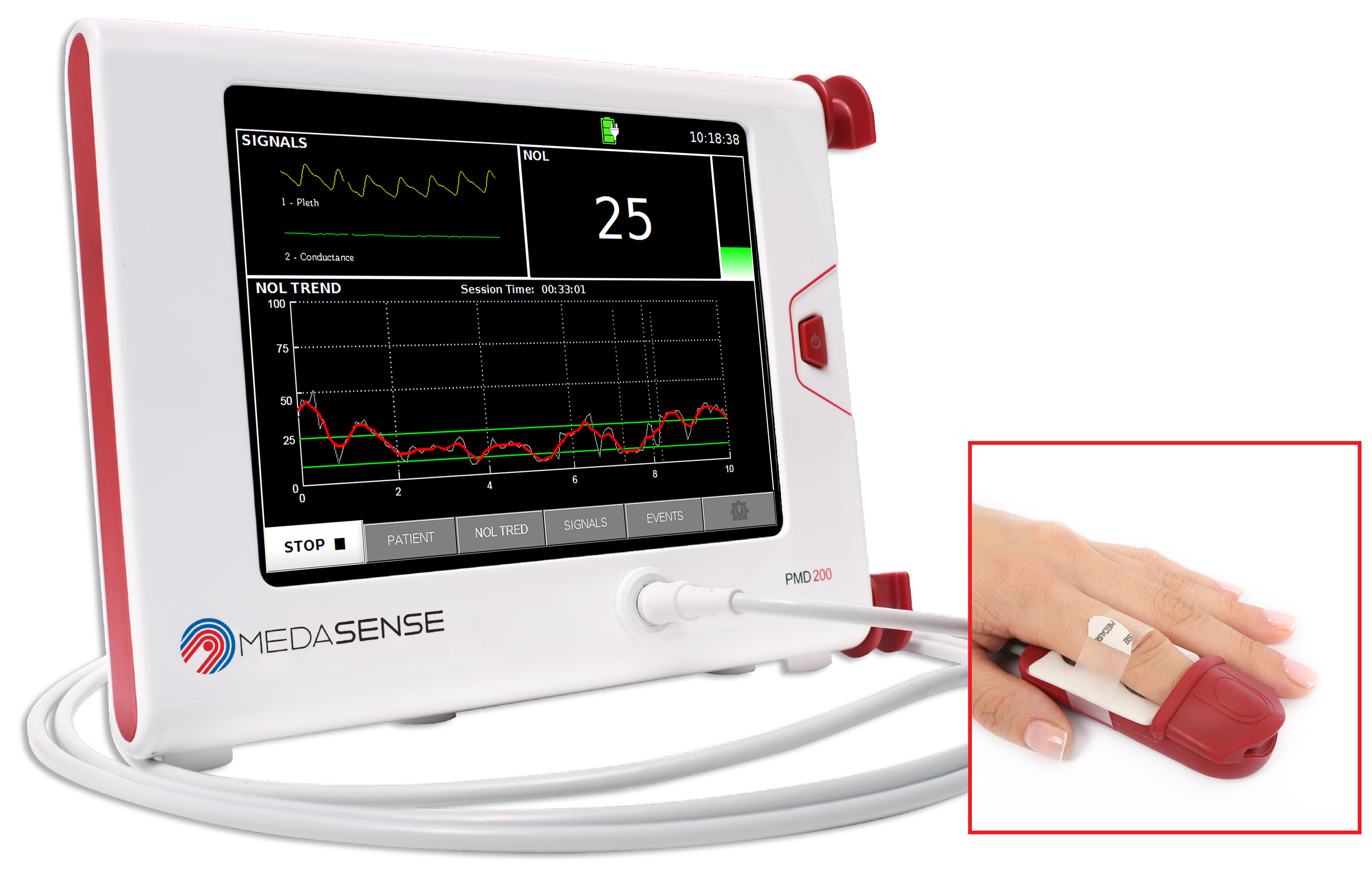 Moniteur Medasense NOL - mesure de la profondeur d'anesthésie - interface non inclus