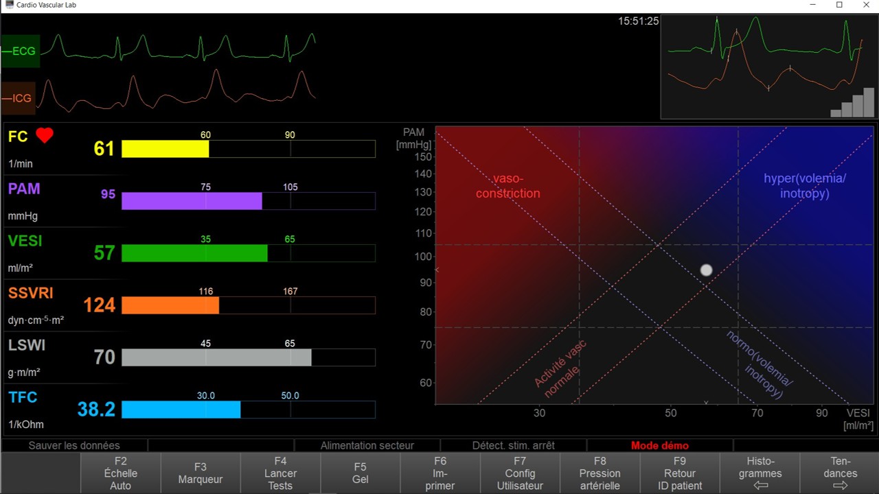 Moniteur NICCOMO-CardioScreen 1000 Pro - Ecran PC Médical Tactile