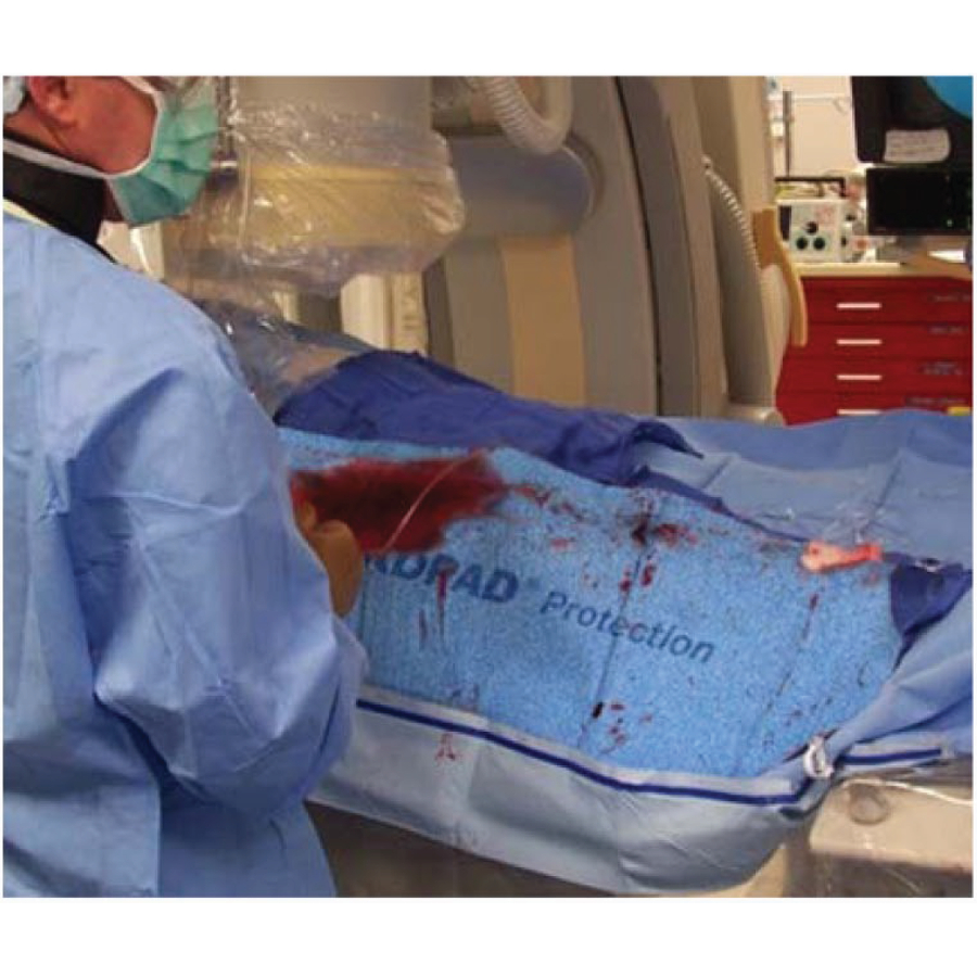 Radpad champ absorbant anti-x 90% eq pb 0,25mm 30 x 86,5 cm périphérique sans plomb - stérile - boîte de 15