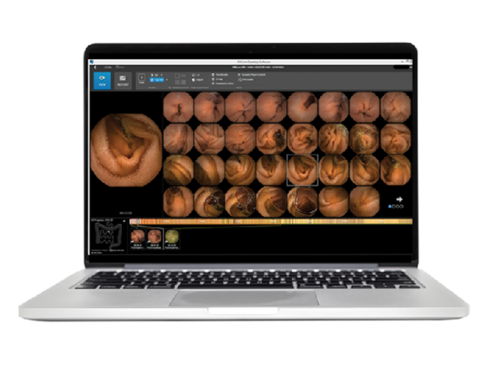 Logiciel d'analyse Pillcam V9