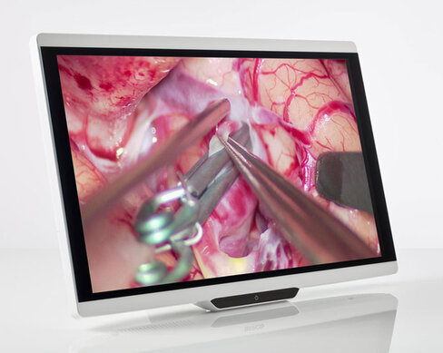 Ecran 2D Full HD à UHD, moniteur 27'' médicalisé ACL LED,