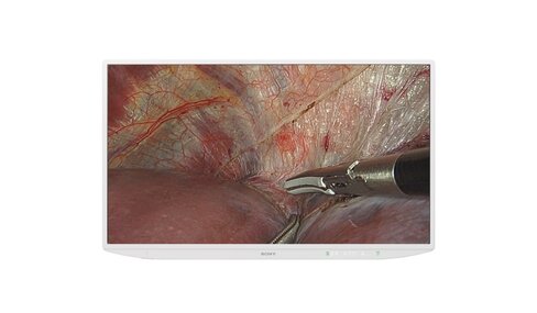 Moniteur Médical Sony 55p 4K LMD-XH550MD