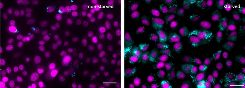 Autophagy Detection Probe Blue Reactivity: Human Size: 1 vial